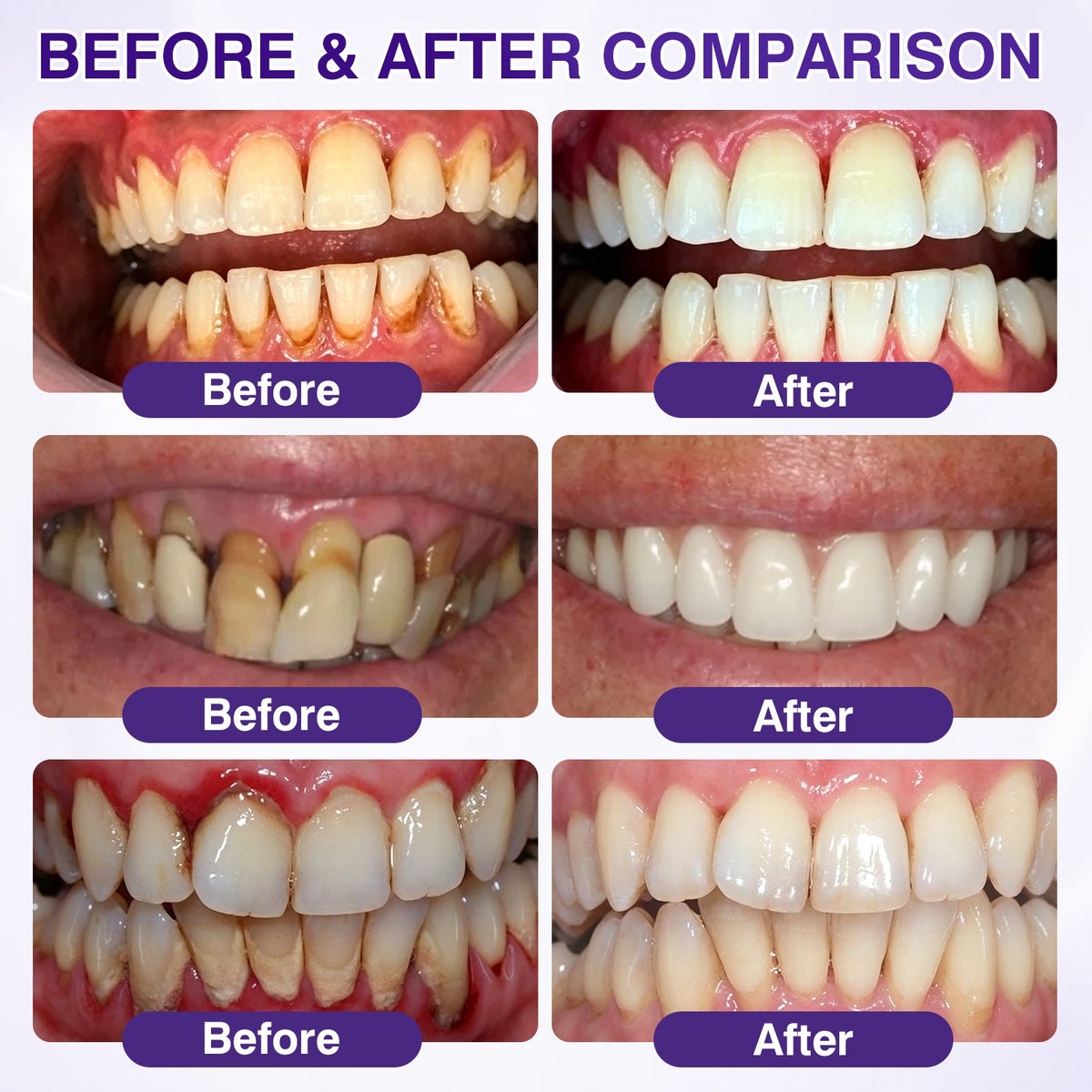 🇦🇺👨‍⚕️✅️Advanced Formula🦷Evolvion® GumRevive Periodontal Repair Gel