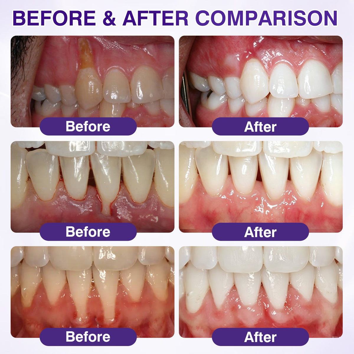 🇦🇺👨‍⚕️✅️Advanced Formula🦷Evolvion® GumRevive Periodontal Repair Gel