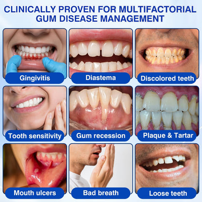 🇦🇺👨‍⚕️🦷🎯Evolvion® GumRevive Periodontal Repair Gel