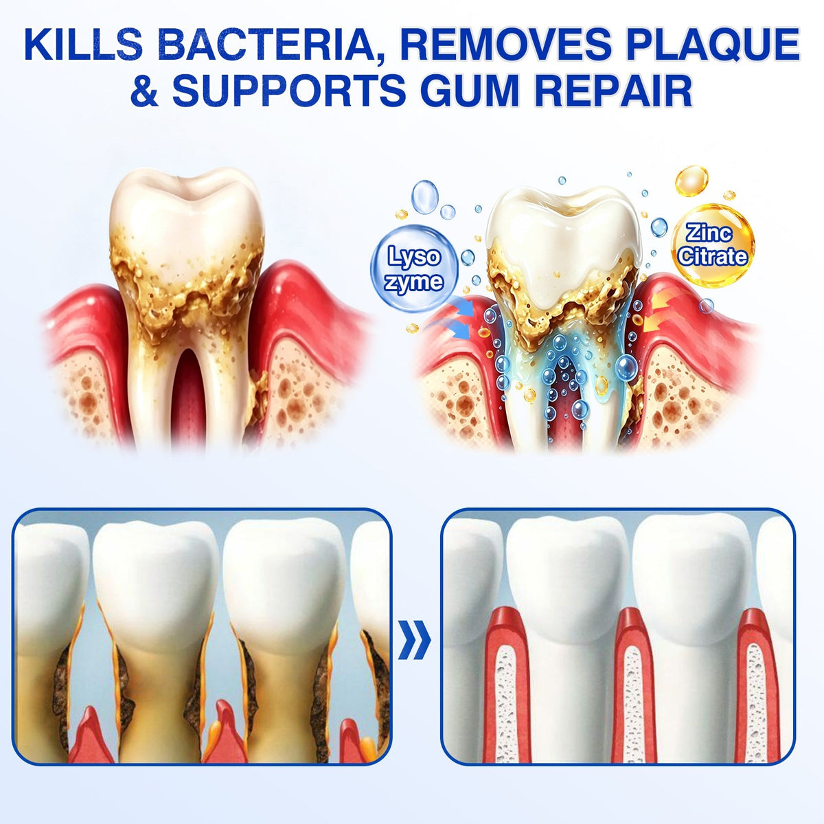 🇦🇺👨‍⚕️🦷🎯Evolvion® GumRevive Periodontal Repair Gel