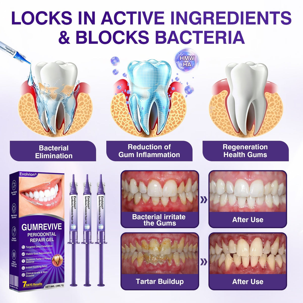 🇦🇺👨‍⚕️✅️Advanced Formula🦷Evolvion® GumRevive Periodontal Repair Gel