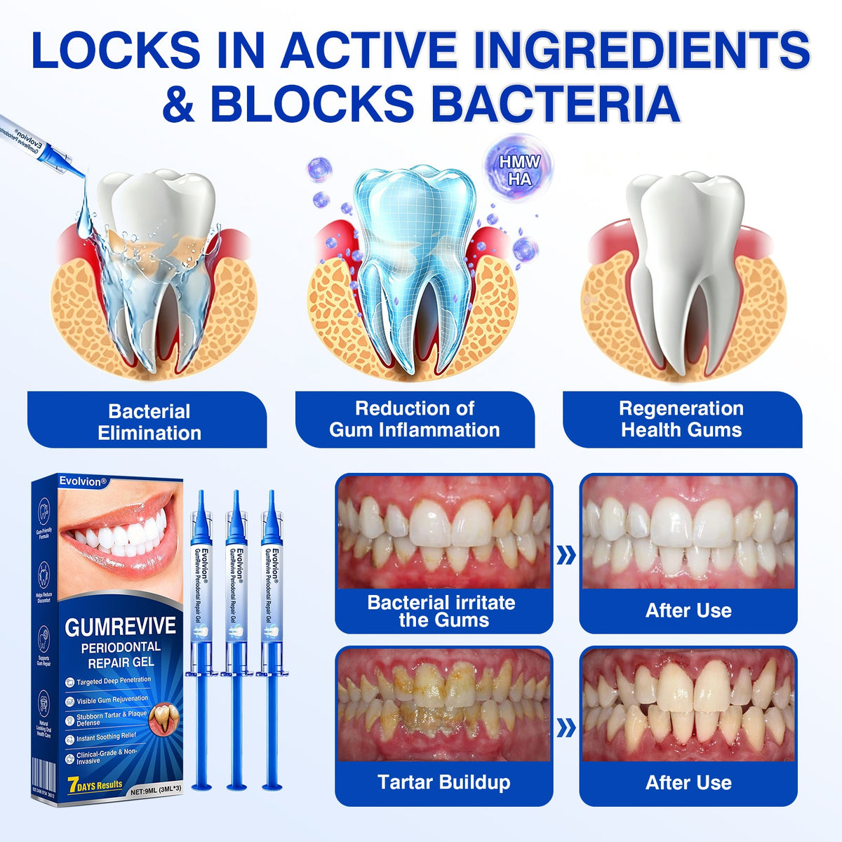 🇦🇺👨‍⚕️🦷🎯Evolvion® GumRevive Periodontal Repair Gel