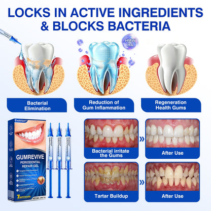 🇦🇺👨‍⚕️🦷🎯Evolvion® GumRevive Periodontal Repair Gel