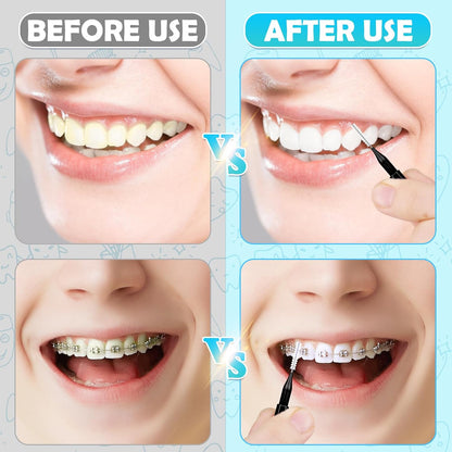 Zolmeron® 120 Pieces Braces Brush Cleaner Orthodontic Flossers Toothpicks Floss Picks for Braces Kit for Teeth Cleaning Tools Spiral Dental Brush Head for Efficient Oral Care Black